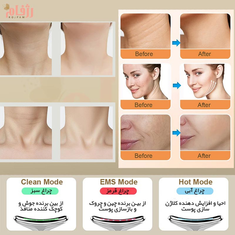 دستگاه ماساژ(ems دار) و لیفت صورت وارداتی مدل ES-1081